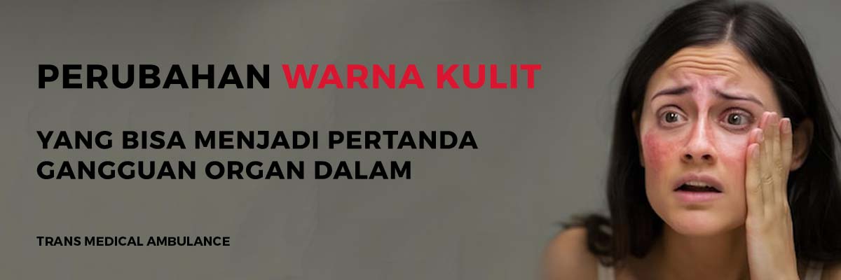 Perubahan Warna Kulit